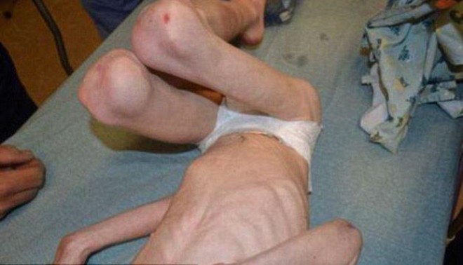 Polis azyaşlını şkafdan ÖLÜMCÜL VƏZİYYƏTDƏ tapdı - Valideyn vəhşiliyi (FOTO)