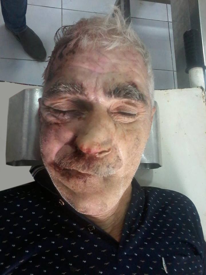 Sumqayıtda kişini maşın vurub öldürdü - Ayağında "TƏMİZ YU" döyməsi var - FOTO