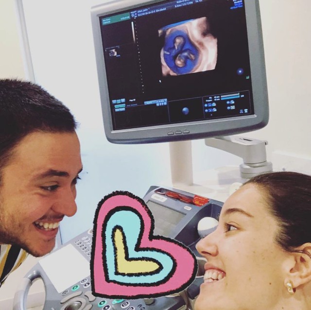 Əkiz uşaqlara hamilə olan aktrisa "donuz qripi"nə tutuldu - VİDEO