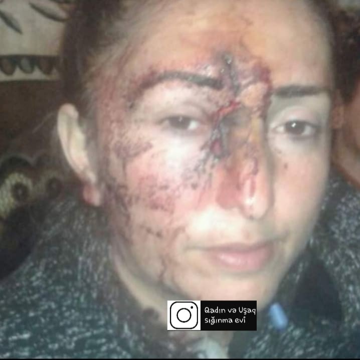 Şəmkirdə ər arvadını yatdığı yerdə vəhşicəsinə döydü - FOTO