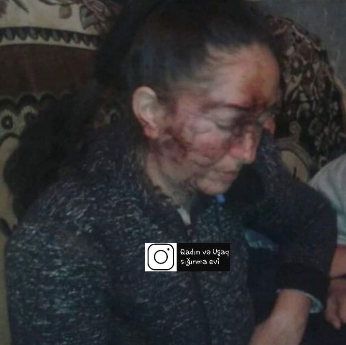 Şəmkirdə ər arvadını yatdığı yerdə vəhşicəsinə döydü - FOTO