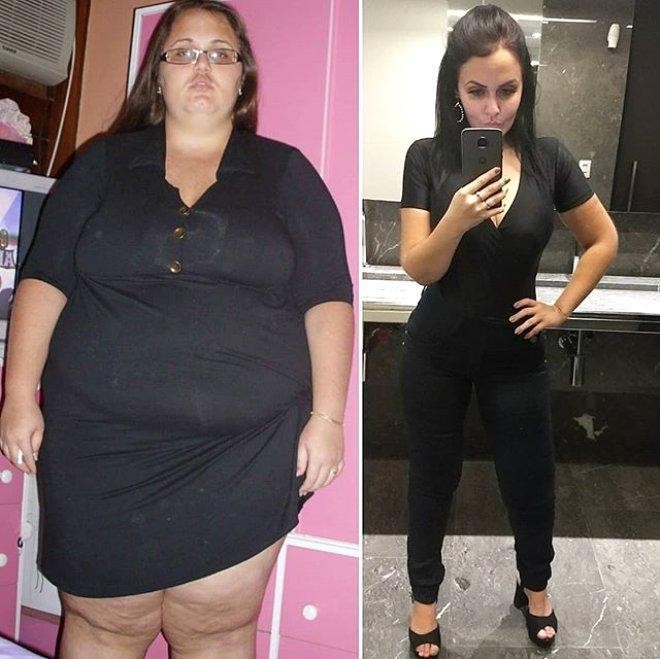 Kök olduğu üçün yataqdan dura bilmirdi - 90 kiloqram arıqlayıb model oldu