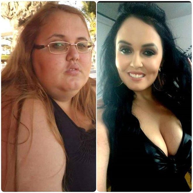 Kök olduğu üçün yataqdan dura bilmirdi - 90 kiloqram arıqlayıb model oldu