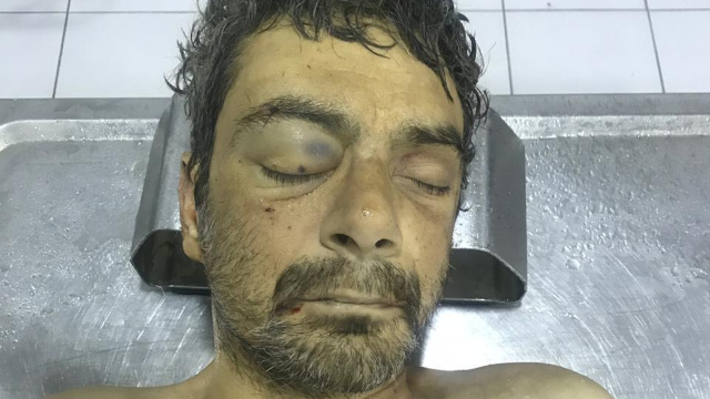 Bakıda kişi araqdan zəhərlənib öldü 