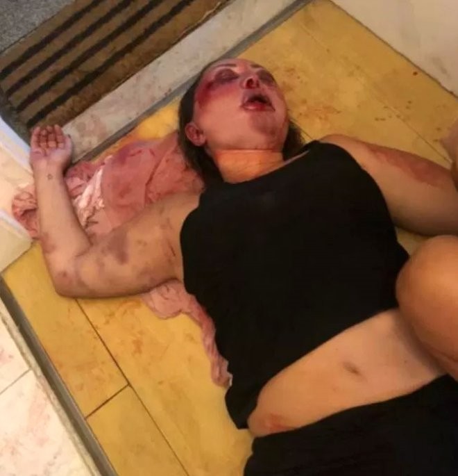 İnternetdə tanış olduğu gənc 57 yaşlı qadını ölümcül hala saldı - FOTOLAR