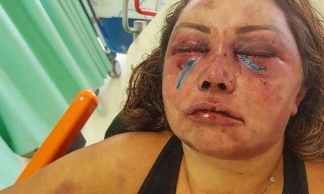 İnternetdə tanış olduğu gənc 57 yaşlı qadını ölümcül hala saldı - FOTOLAR
