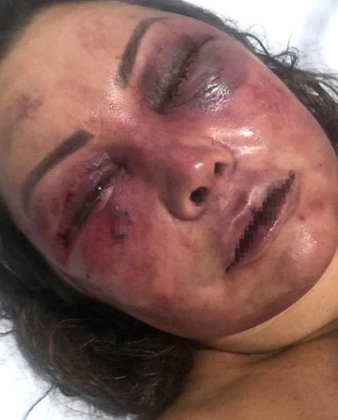 İnternetdə tanış olduğu gənc 57 yaşlı qadını ölümcül hala saldı - FOTOLAR