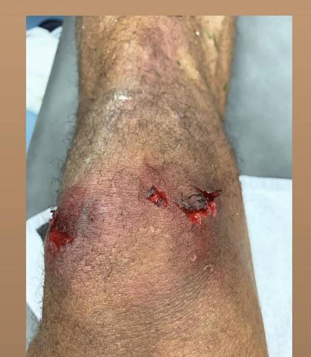 “El klasiko”da oynayan futbolçunun dizi çapıldı - FOTO