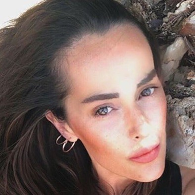 Plastik əməliyyatlardan tanınmaz hala düşdü - FOTO