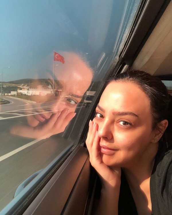 Ebru Gündeş tanınmaz halda - FOTO