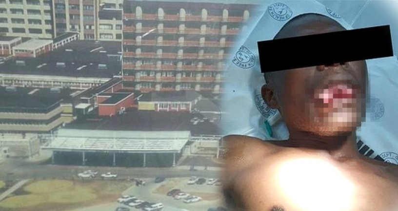 Qadın həkim ona təcavüz edən manyakın dilini qopardı - FOTO