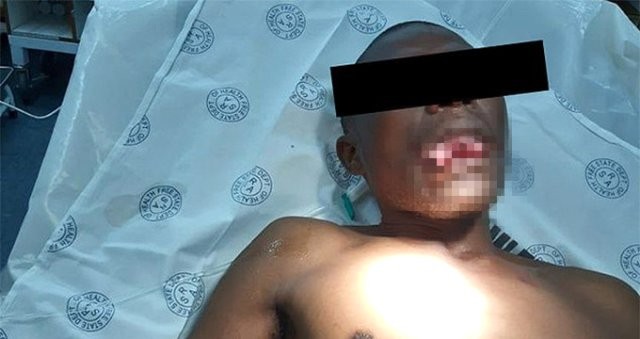 Qadın həkim ona təcavüz edən manyakın dilini qopardı - FOTO