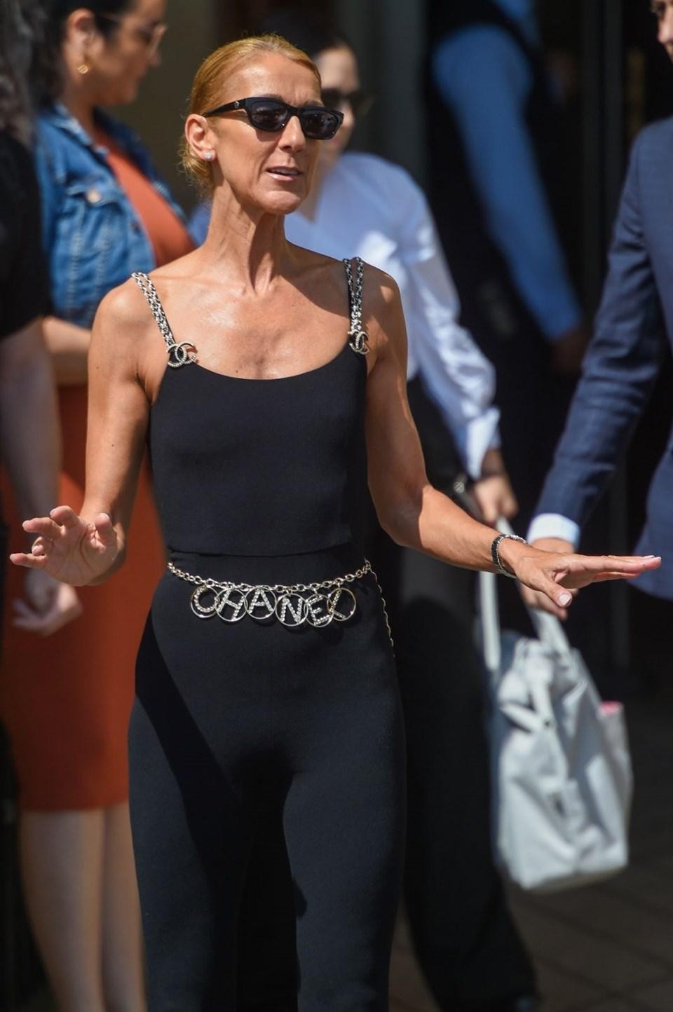 Bir dəri, bir sümük qalıb - FOTOLAR