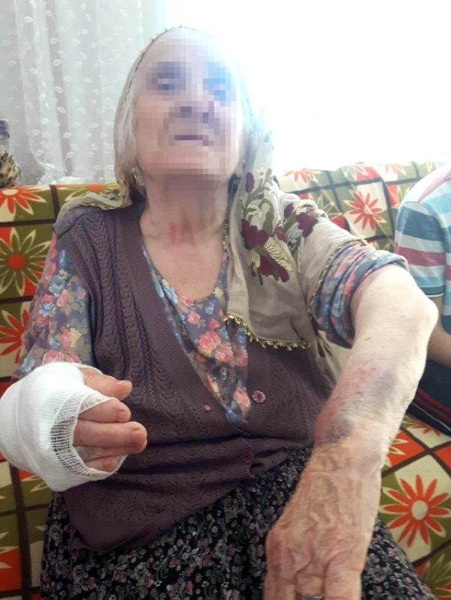 Gəlin 92 yaşlı qayınanasını döyüb, qolunu qırdı - FOTO + VİDEO