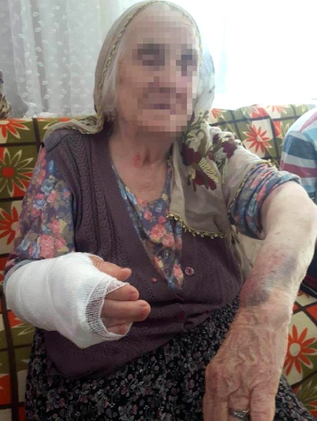 Gəlin 92 yaşlı qayınanasını döyüb, qolunu qırdı - FOTO + VİDEO