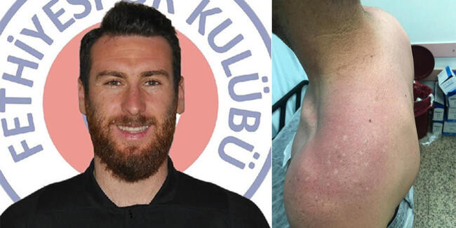 Klub prezidentinin mühavizəçisi futbolçunu vəhşicəsinə döydü - FOTO