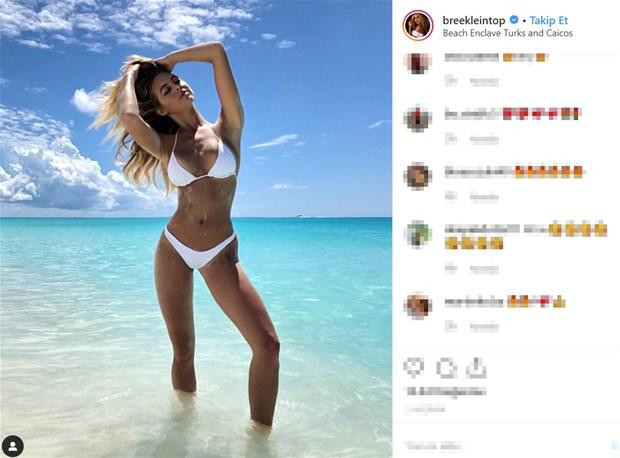 25 yaşlı model bu fotolara görə "hədəf" oldu 