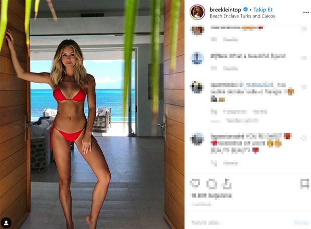 25 yaşlı model bu fotolara görə "hədəf" oldu 