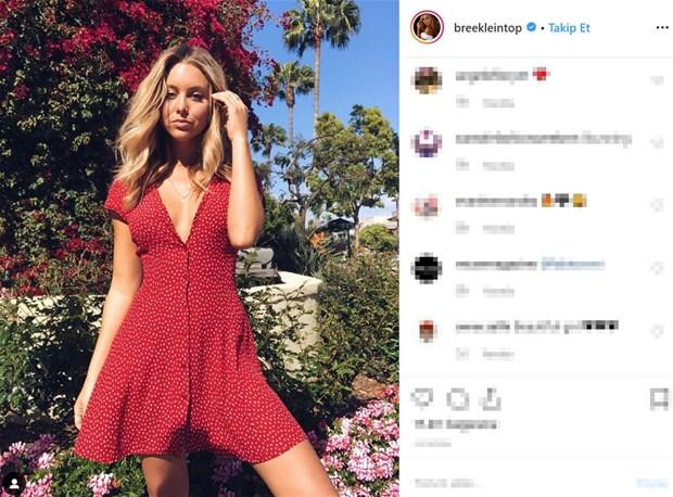 25 yaşlı model bu fotolara görə "hədəf" oldu 