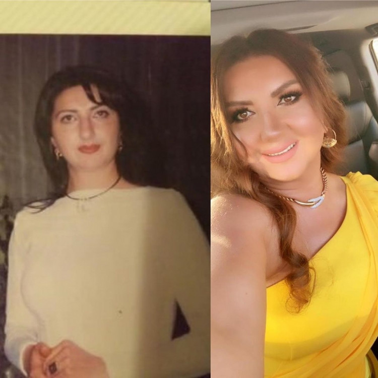 Nazilə 10 il əvvəl belə idi - FOTO
