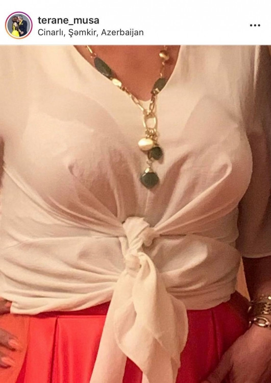 Təranə sinəsinin şəklini paylaşdı - FOTO