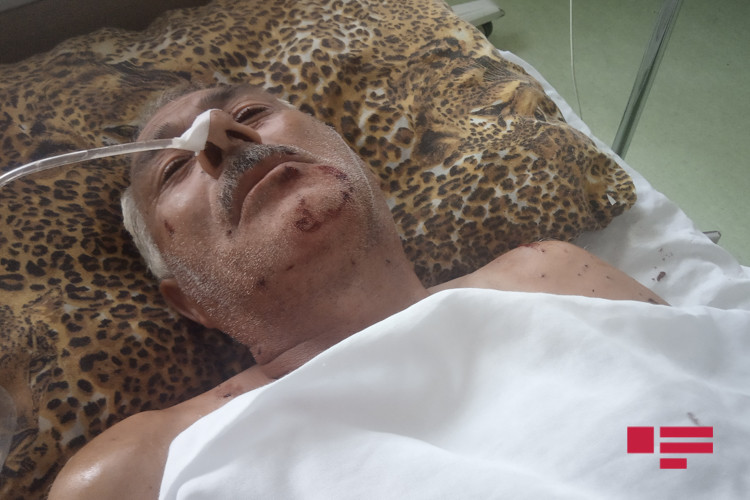 Tərtərdə toydan gəlib, qumbara partladaraq intihar etdi - RƏSMİ