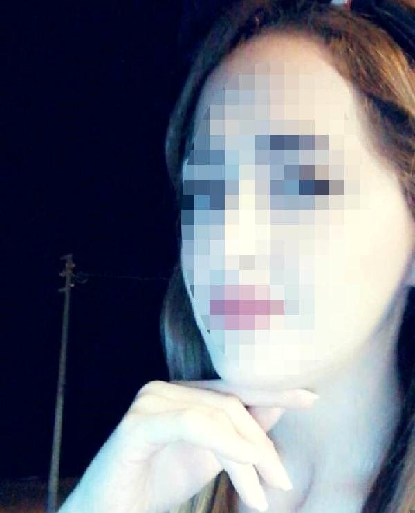 Küçədə gəzən iki qadına avtomobildən atəş açdılar - FOTO
