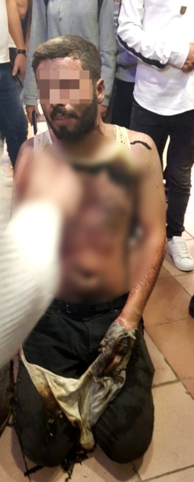 Bazarda arvadıyla dalaşan kişi özünü yandırdı - FOTO+VİDEO