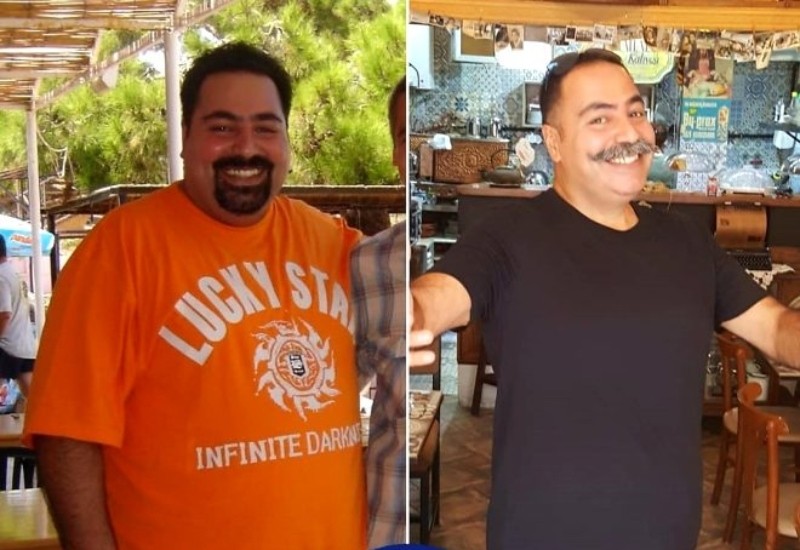 Aktyor 65 kiloqram arıqladı - FOTO