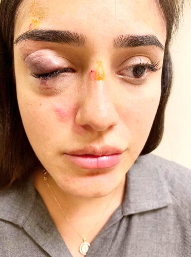 Nişanlısı 6 aylıq hamilə olan aktrisanı bu hala saldı (FOTO)