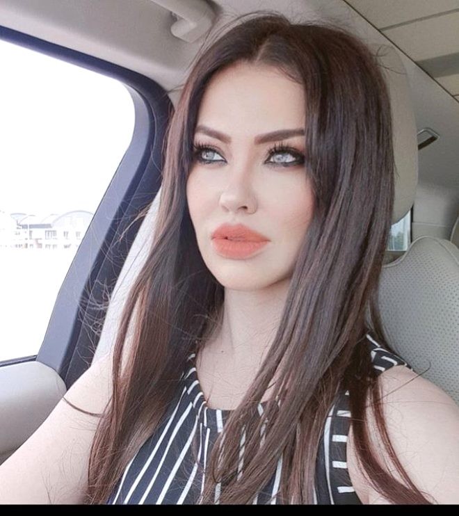 Müğənni estetik əməliyyatlardan sonra tanınmaz hala gəldi - FOTOLAR