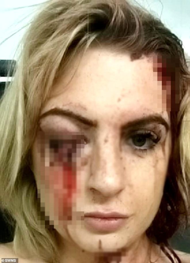 İdman zalından çıxan qadına çəkiclə hücum etdilər - FOTOLAR