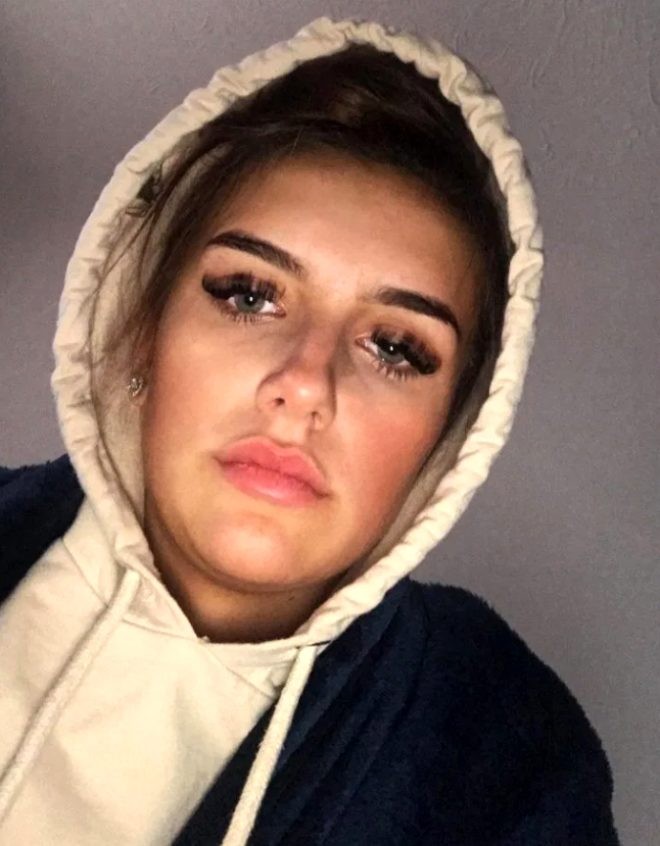 "Selfi" çəkdi, paltarında gizlənən hörümçəyi dostları gördü - FOTOLAR
