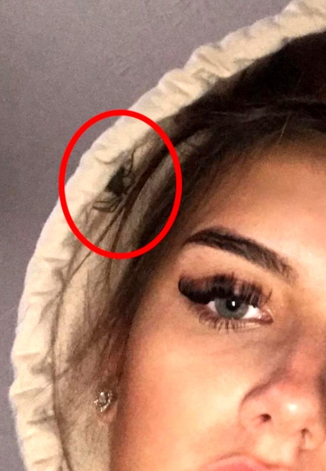 "Selfi" çəkdi, paltarında gizlənən hörümçəyi dostları gördü - FOTOLAR