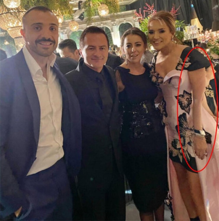 O qədər fotoşop etdi ki, qolu əyildi 