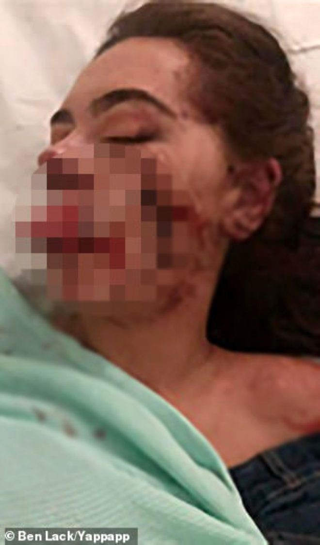 Gecə klubunun qarşısında gənc qızı... - FOTOLAR