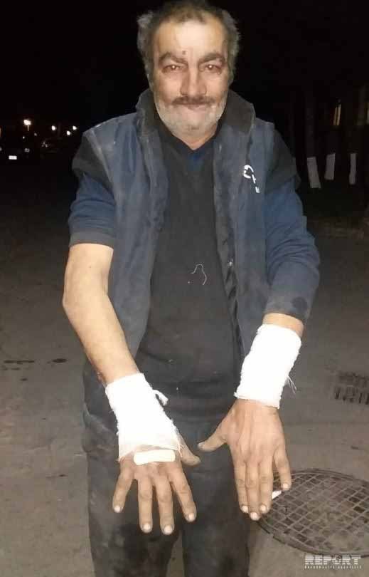 Bakıda canavar peydə oldu: bir nəfəri parçaladı (FOTO)