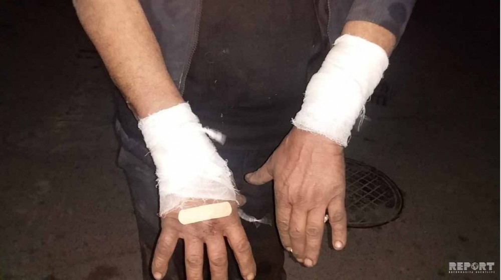 Bakıda canavar peydə oldu: bir nəfəri parçaladı (FOTO)