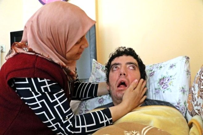 Rəqs məktəbi açmaq istəyən adam 6 ildir göz qapaqlarını bağlamır - FOTOLAR