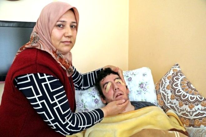 Rəqs məktəbi açmaq istəyən adam 6 ildir göz qapaqlarını bağlamır - FOTOLAR
