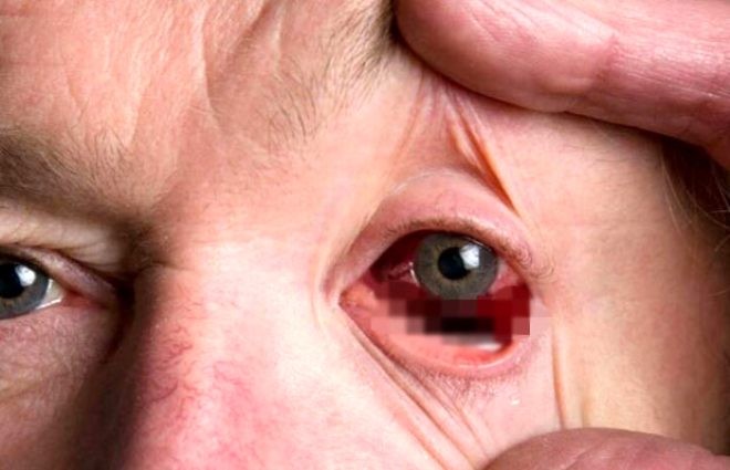 Daha bir virus aşkarlandı - FOTO