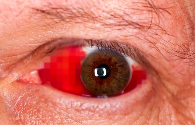 Daha bir virus aşkarlandı - FOTO