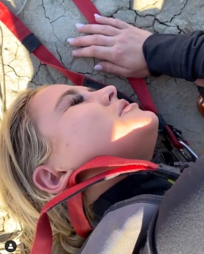 Məşhur modelin ayağı belə qırıldı - FOTOLAR