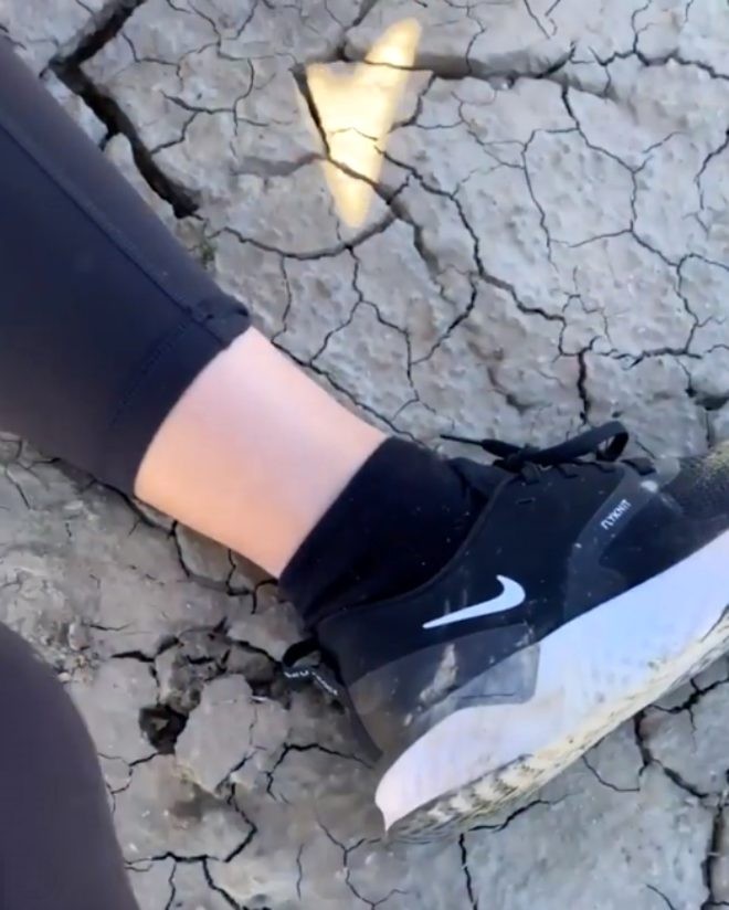 Məşhur modelin ayağı belə qırıldı - FOTOLAR