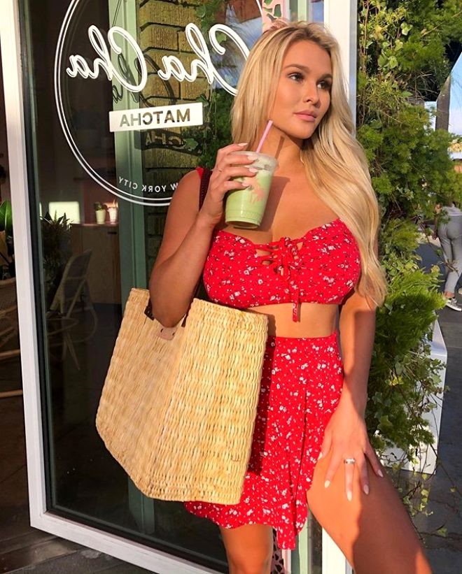 Məşhur modelin ayağı belə qırıldı - FOTOLAR