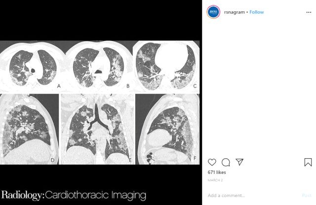 Çinli alimləri şok edən kokronavirus görüntüləri FOTO+VİDEO