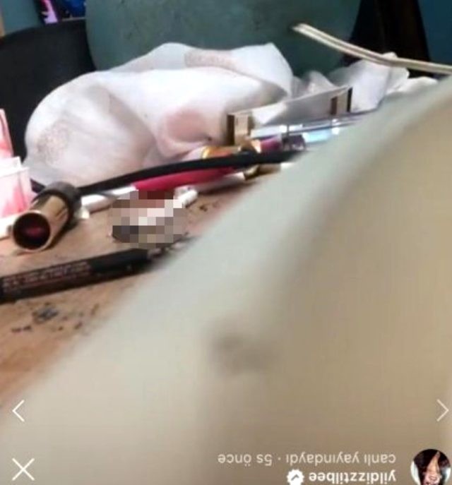 Bu məşhur canlı yayım zamanı kameranı tərs çevirdi... FOTO