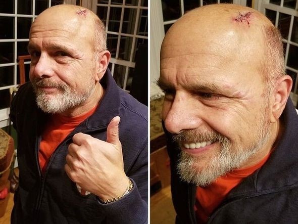 Məşhur aktyoru maşın vurdu - FOTO