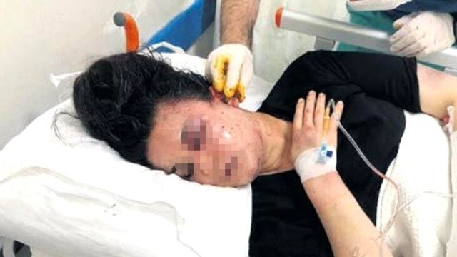 Arvadını meşəyə aparıb, işgəncə verdi - FOTO