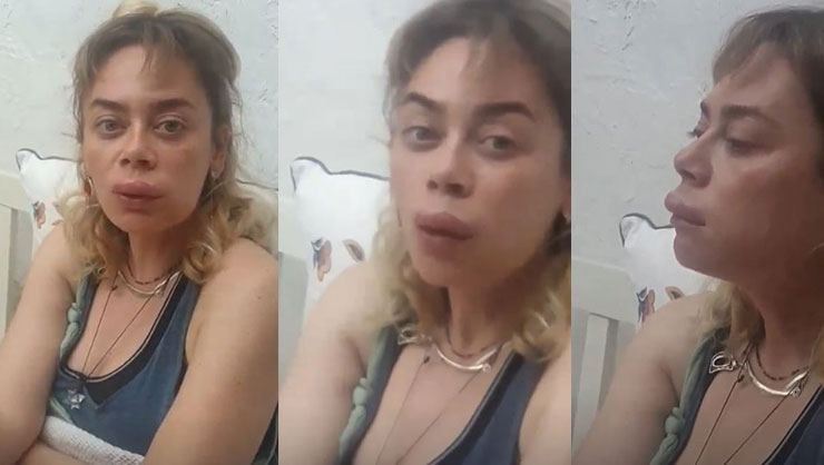 Məşhur aktrisa tanınmaz halda - FOTO